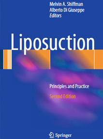 Liposuction book cover– Principles and Practice second edition 2016